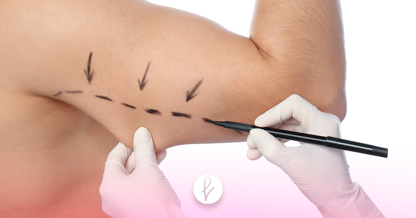 En qué consiste el procedimiento en una braquioplastia