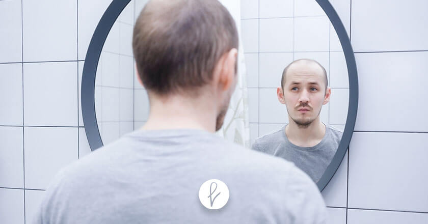 ¿Cómo afecta la alopecia a nivel psicológico?