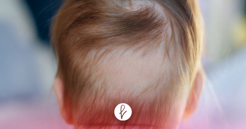 ¿Cómo se clasifica la alopecia infantil?