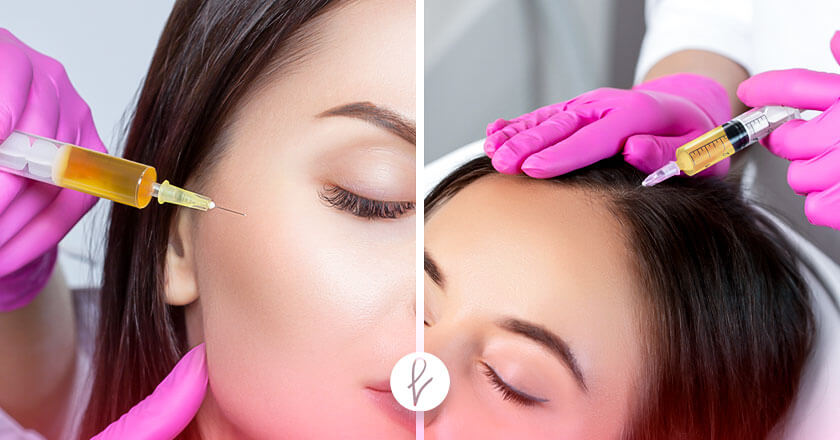 ¿Para qué zonas es recomendable el PRP?