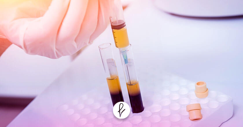 ¿Qué es el plasma rico en plaquetas en Surco? ¿Qué es el plasma rico en plaquetas en Surco?