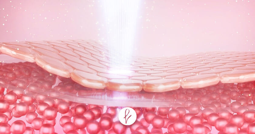 ¿Cómo funciona la radiofrecuencia facial? ¿Cómo funciona la radiofrecuencia facial?