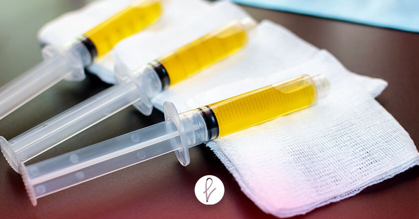 PRP vs. Microdermoabrasion para las estrías: