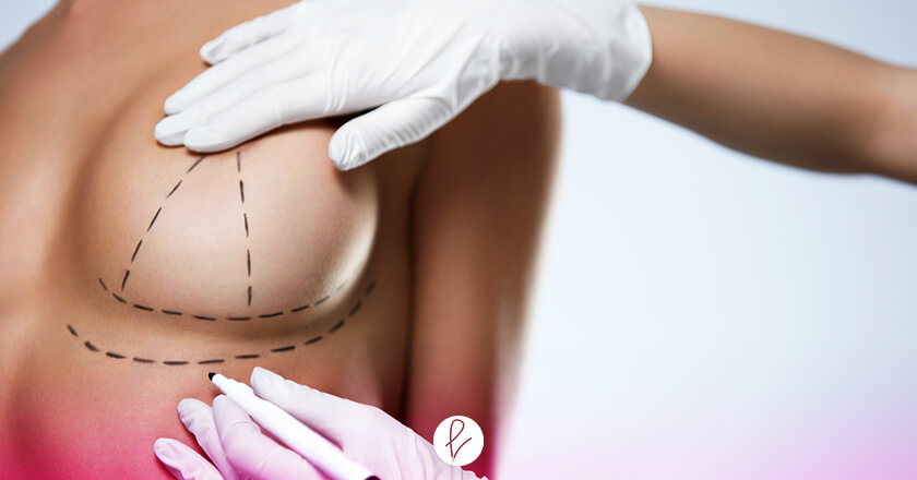 ¿Qué es la Mamoplastia?