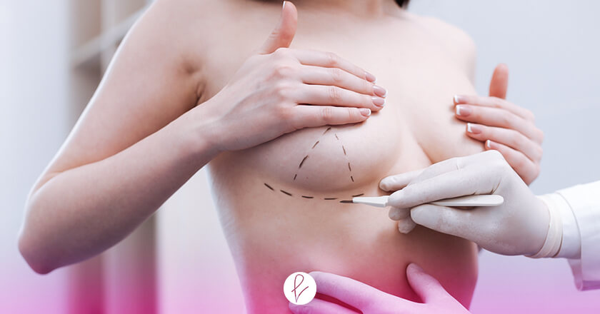 Mamoplastia en Perú