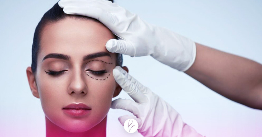 Tipos de Blefaroplastia