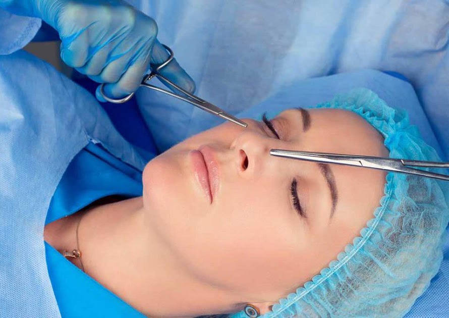 Rinoplastia Abierta y Cerrada: ¿Cuál es Mejor?