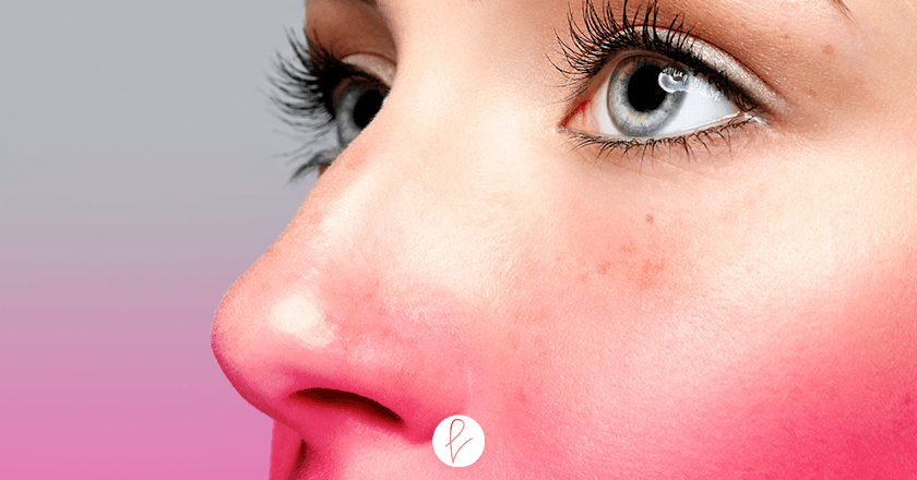 Cómo prepararse para la operación de nariz Cómo prepararse para la operación de nariz