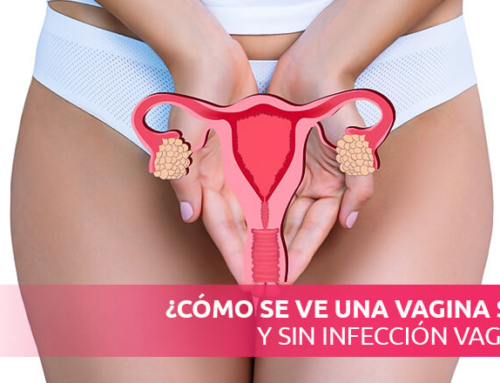 ¿Cómo se ve una vagina sana y sin infección vaginal?