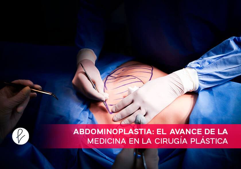 Abdominoplastia: el avance de la medicina en la cirugía plástica