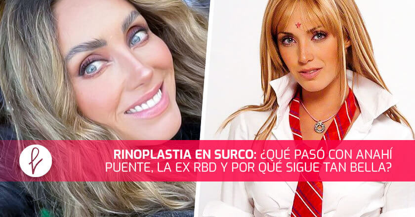 Rinoplastia en Surco: ¿Qué pasó con Anahí Puente, la ex RBD y por qué sigue tan bella?