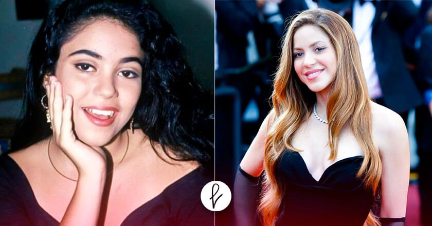 Shakira: su antes y después con cirugía estética, según telecinco