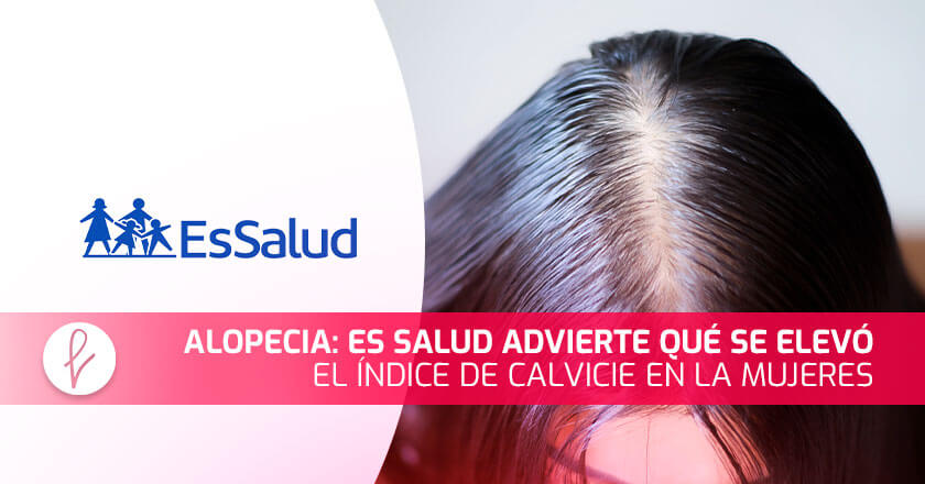 Alopecia: Es Salud advierte qué se elevó el índice de calvicie en la mujeres