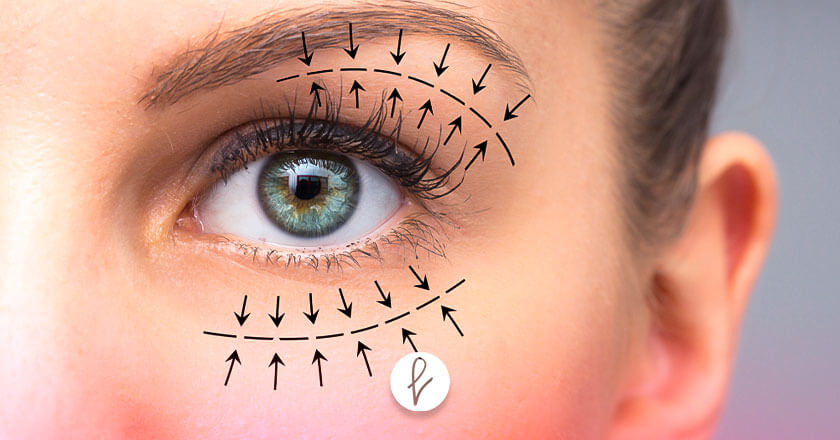 ¿Cuáles son los tipos de Blefaroplastia?