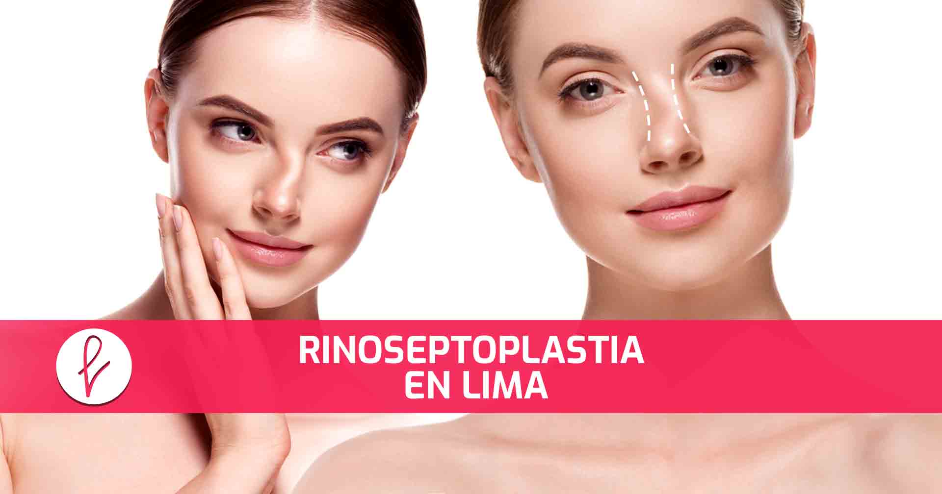 Rinoseptoplastia en Lima