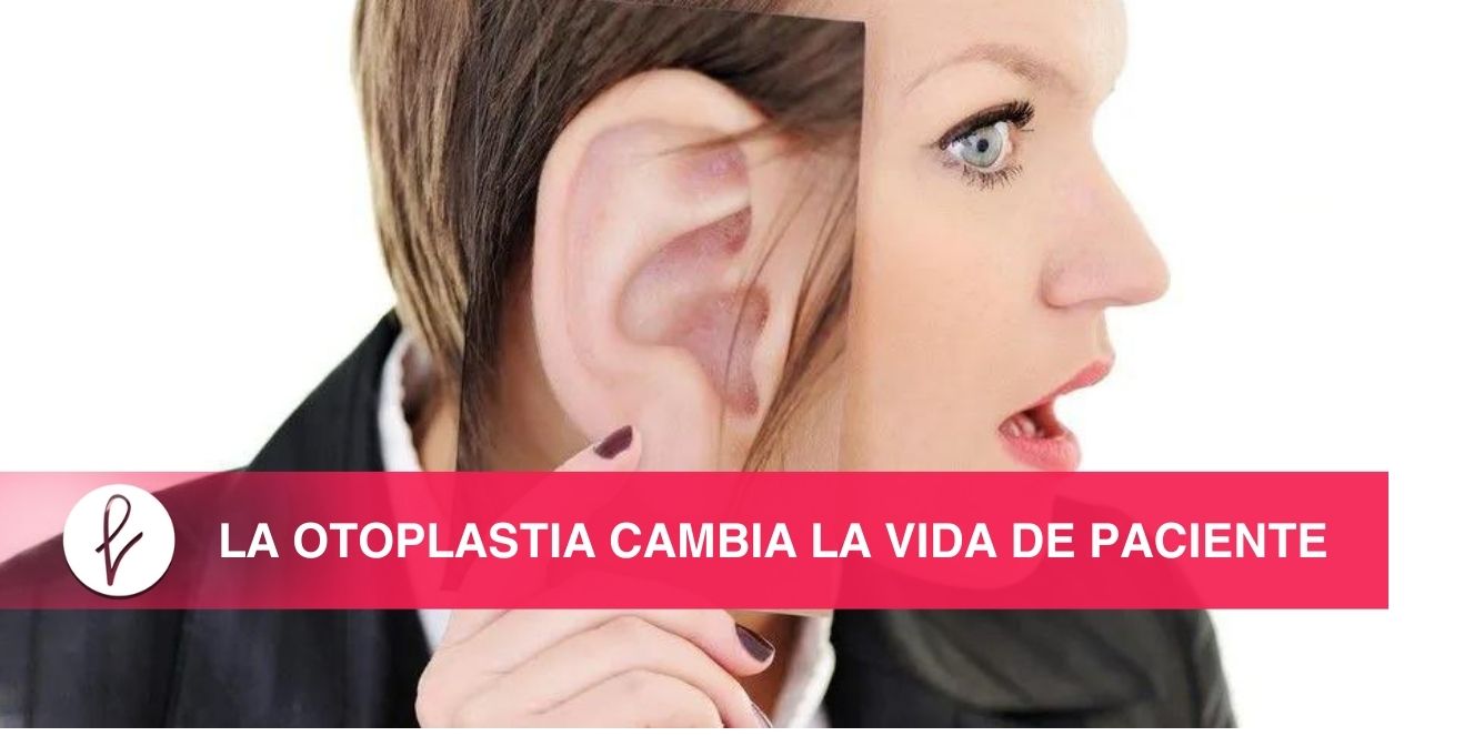La Otoplastia cambia la vida de paciente