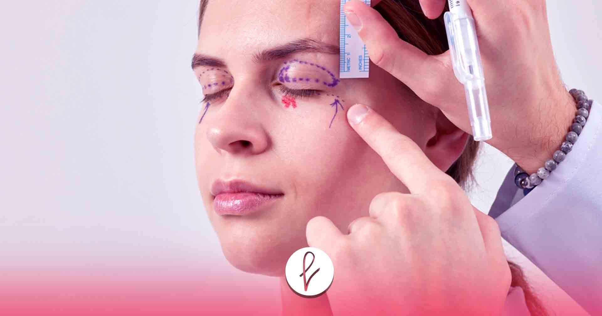 Blefaroplastia - Cirugía Plástica