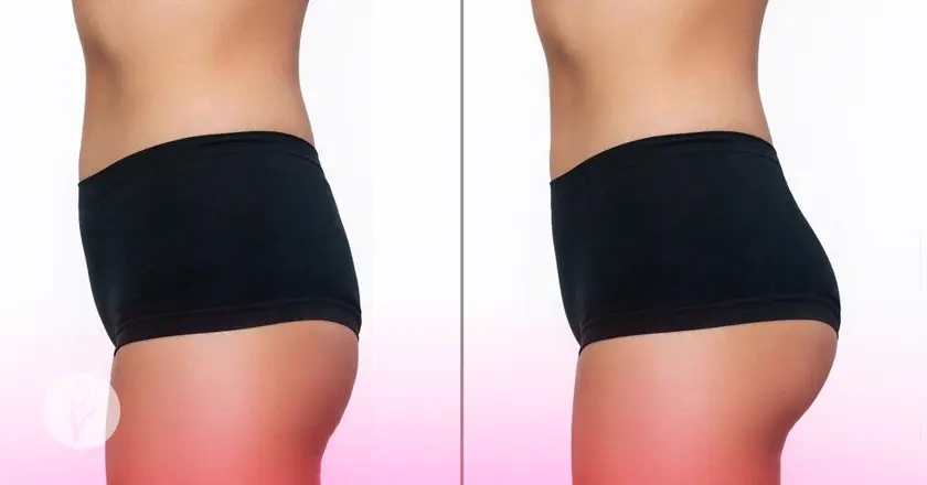 ¿Cuáles son los beneficios de la gluteoplastia con grasa?