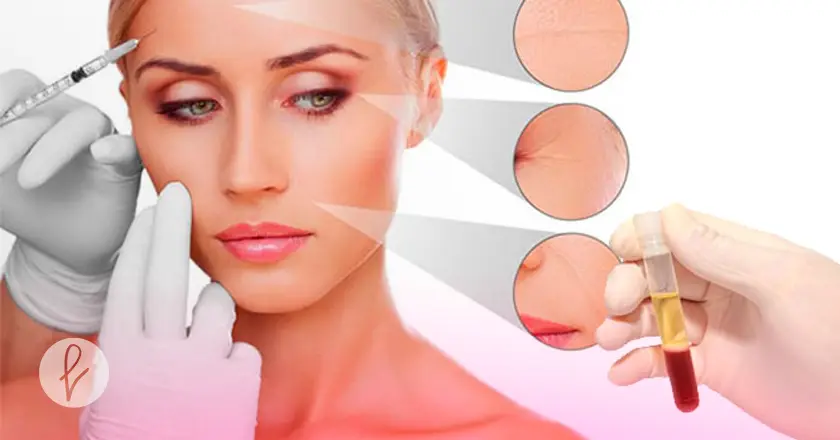 ¿Qué es el PRP facial con Dermapen?