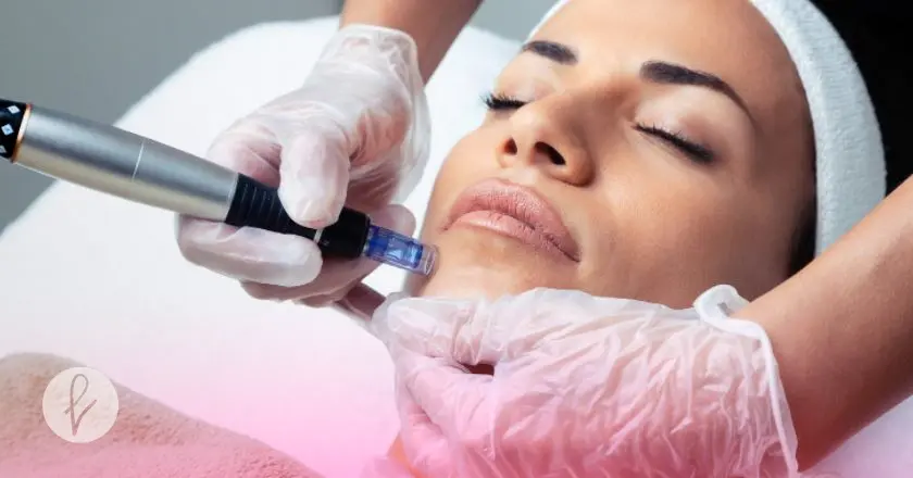 ¿Cómo se realiza una sesión de PRP facial con Dermapen?