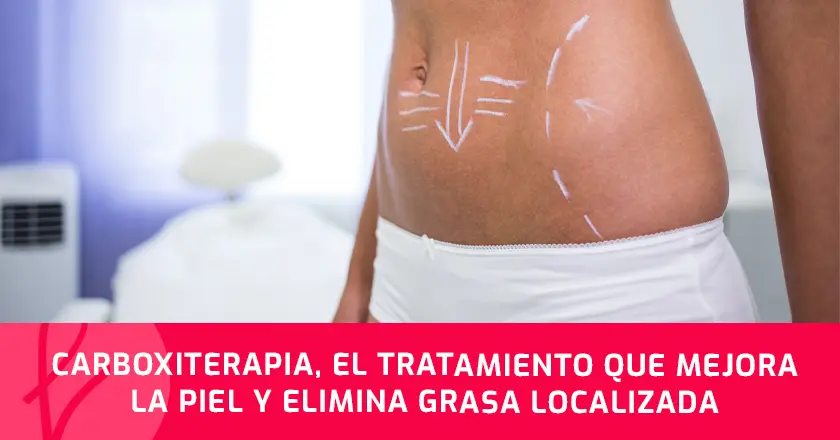 Carboxiterapia, el tratamiento que mejora la piel y elimina grasa localizada