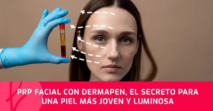 PRP facial con Dermapen, el secreto para una piel más joven y luminosa