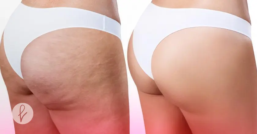 Contraindicaciones y cuidados posteriores 