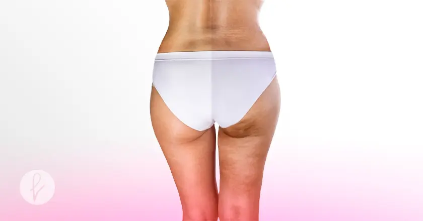 ¿Cómo se realiza una sesión de ultracavitación?