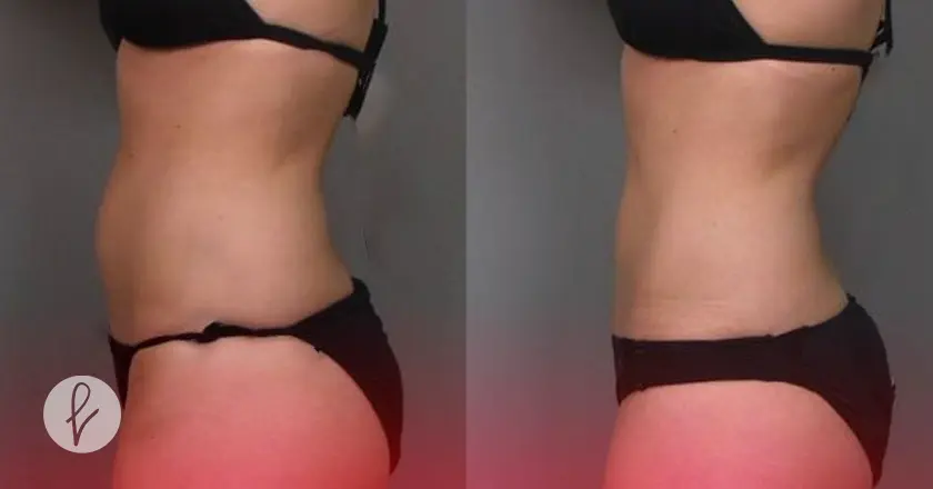 ¿Cuántas sesiones se necesitan?