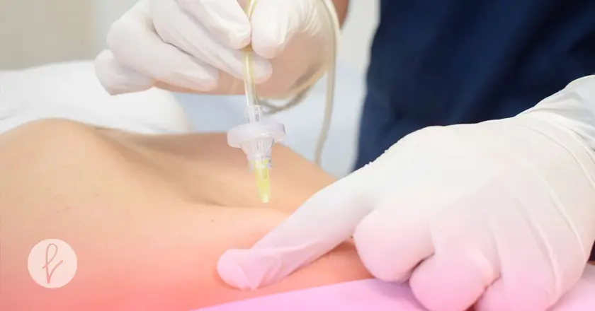 ¿Cómo se realiza el tratamiento?