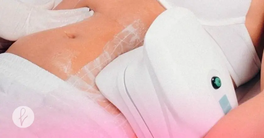 ¿Qué es la criolipólisis?