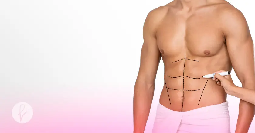 ¿Qué es la Definición Abdominal Masculina?