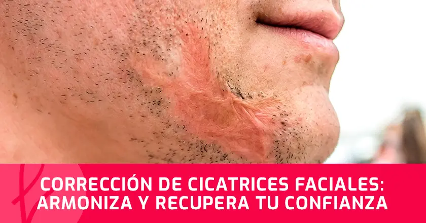 Corrección de Cicatrices Faciales: Armoniza y Recupera tu Confianza