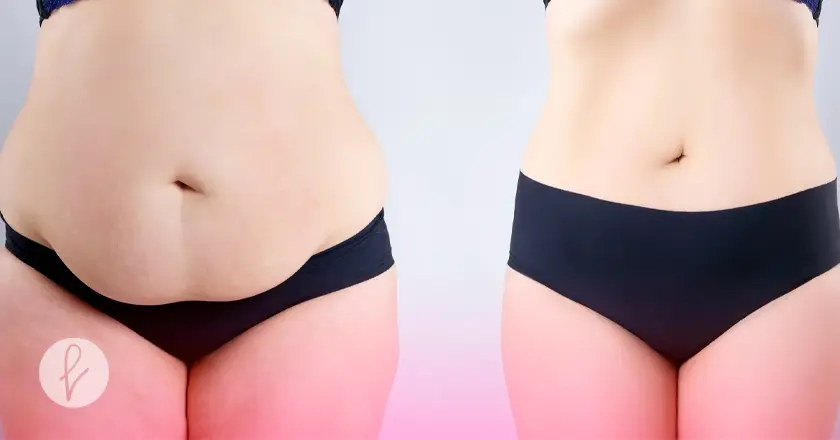 Recuperación y cuidados posteriores