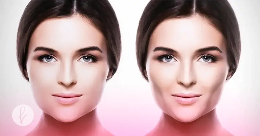 ¿Quiénes son candidatos para un afinamiento maxilofacial?