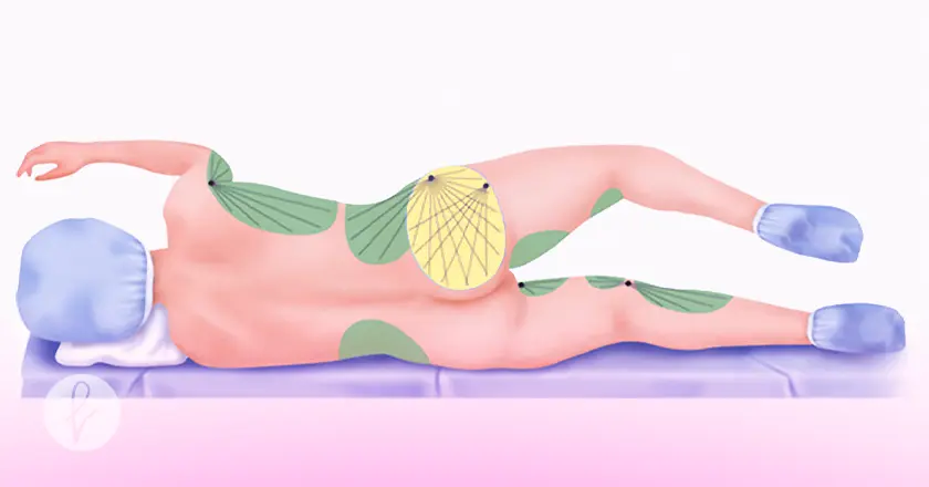 ¿Cómo se realiza el procedimiento?